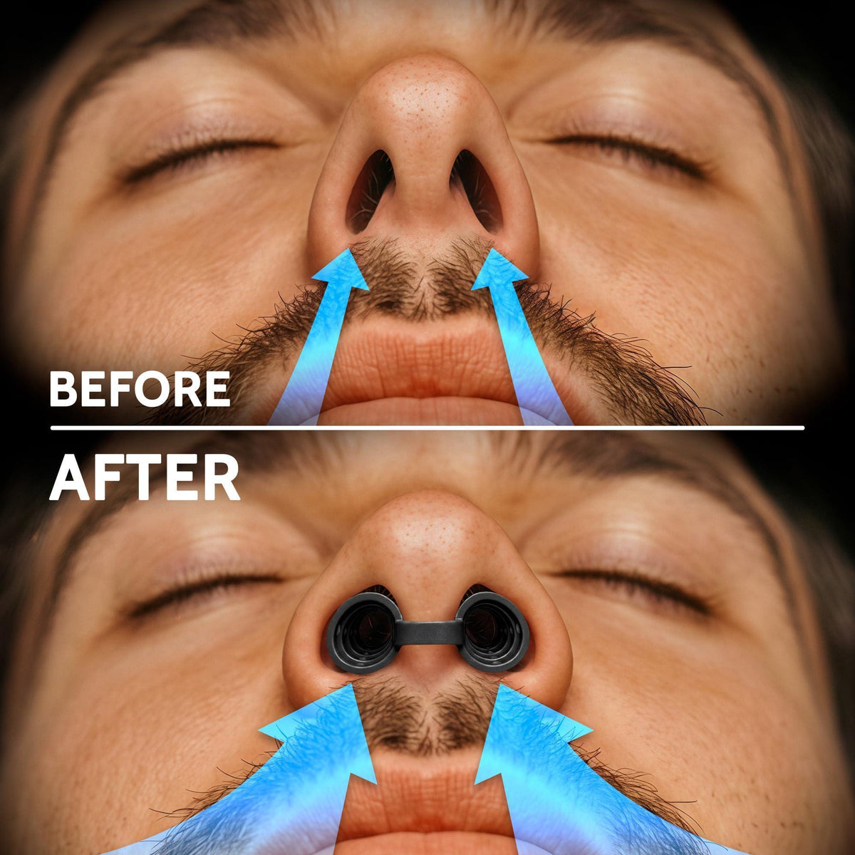 Nasal Dilators for Sleeping & Breathing (8 Pairs 4 Sizes) – Soft EVA Internal Nose Vents to Help Open Nostrils – Support Nasal Airflow & Nasal Related Snoring